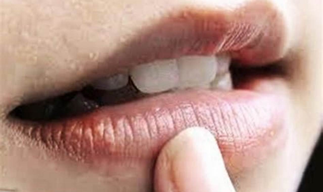 Cara Mengatasi Bibir Bengkak: Tutorial Lengkap
